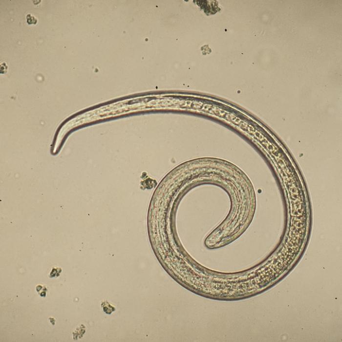 Diese Parasiten in Lebensmitteln können krank machen