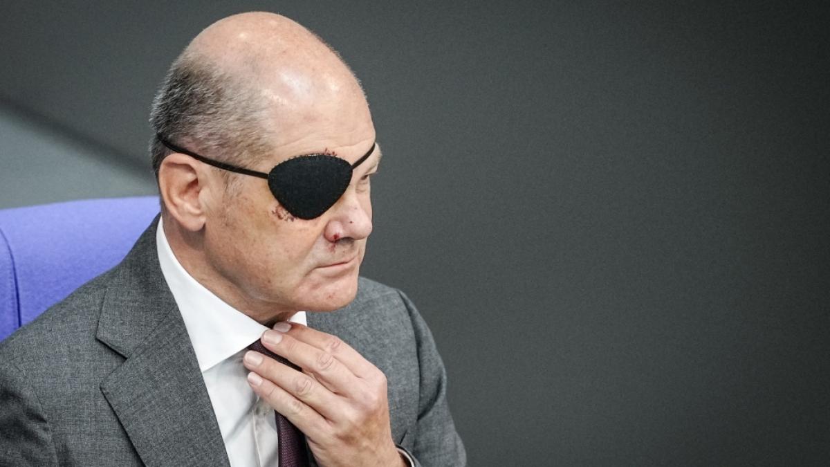 Bundeskanzler Olaf Scholz hat kurz nach seinem Joggingunfall eine neue Wunde im Gesicht. (Foto)