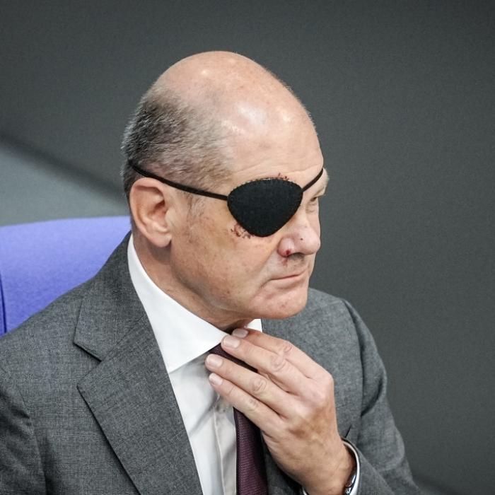 Nächste Wunde im Gesicht! Bundeskanzler wieder verletzt