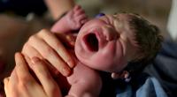 In Indien brachte eine Frau ein Baby mit vier Armen und vier Beinen auf die Welt. (Symbolbild)