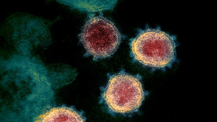 Diese Aufnahme, die von den U.S. National Institutes of Health im Februar 2020 zur Verfügung gestellt wurde, zeigt das neuartige Coronavirus (SARS-CoV-2), das Covid-19 verursacht.
