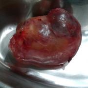 Der teilentwickelte Foetus ist ca. sieben Zentimeter lang und wiegt 150 Gramm.