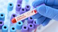 Weltweit dominiert aktuell die Corona-Variante 