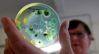 Im Wasserlabor im Landesamt für Gesundheit und Soziales LAGuS hält Dagmar Dammann, Medizinisch-Technische Assistentin, eine Petrischale mit CBS-Agar-Nährmedium, in der sich Vibrionen entwickelt haben.