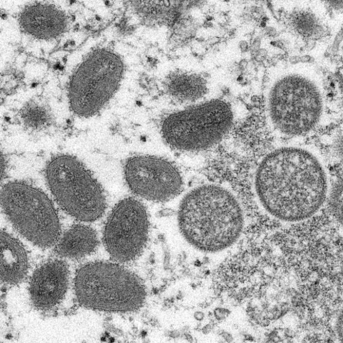Verursacht durch Corona-Impfung? Verrückte Verschwörungstheorien zum Affenpocken-Virus
