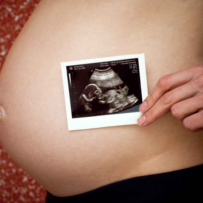 14-Jährige bekommt Baby während Klassenfahrt