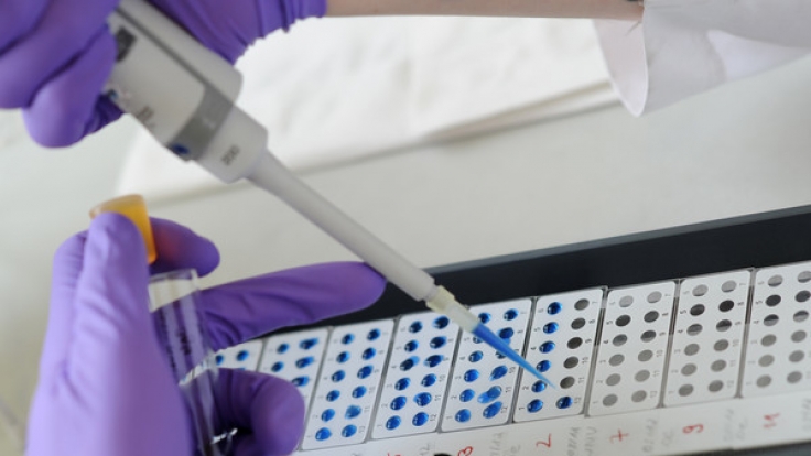Infektionen mit dem Hantavirus nehmen im Südwesten rasant zu. Seit Beginn des Jahres wurden dem Landesgesundheitsamt 464 Erkrankungen gemeldet, wie das Gesundheitsministerium am Sonntag in Stuttgart mitteilte.