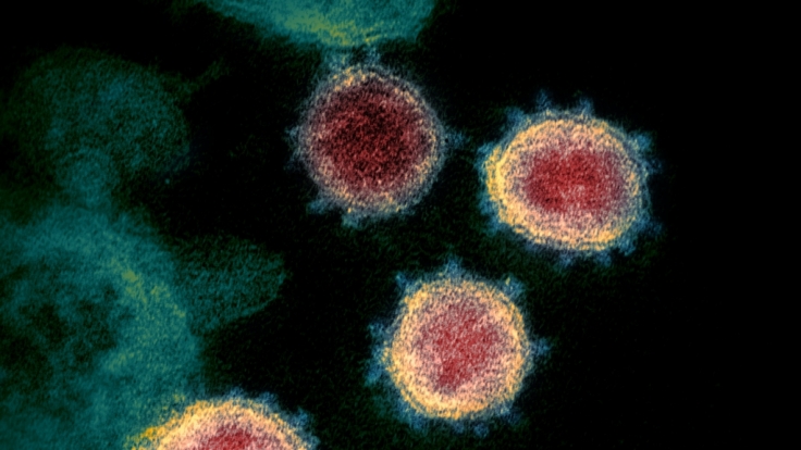 Das Coronavirus - hier eine elektronenmikroskopische Aufnahme des Erregers Sars-CoV-2 - bildet unentwegt neue Varianten durch Mutationen aus.